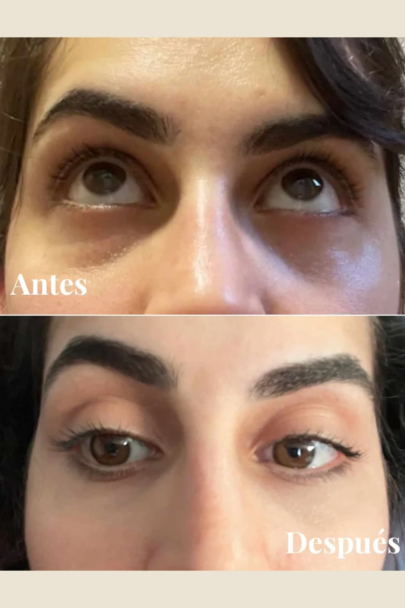 Contorno de ojos revitalizador