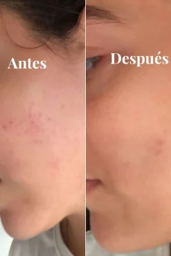 Sérum iluminador antimanchas